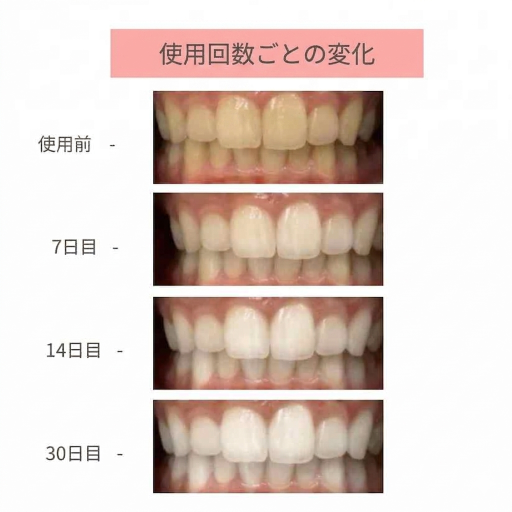 Ceelike ホワイトニングシート｜過酸化物不使用。 自宅で・やさしく・30分で